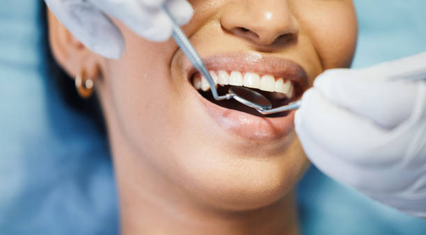 Best Knocked-Out Tooth Emergency  in Carlisle, OH